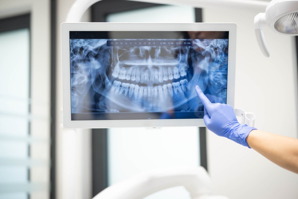 A dental professional wearing gloves points to a dental X-ray displayed on a monitor, highlighting details of a patient's teeth for review or diagnosis.