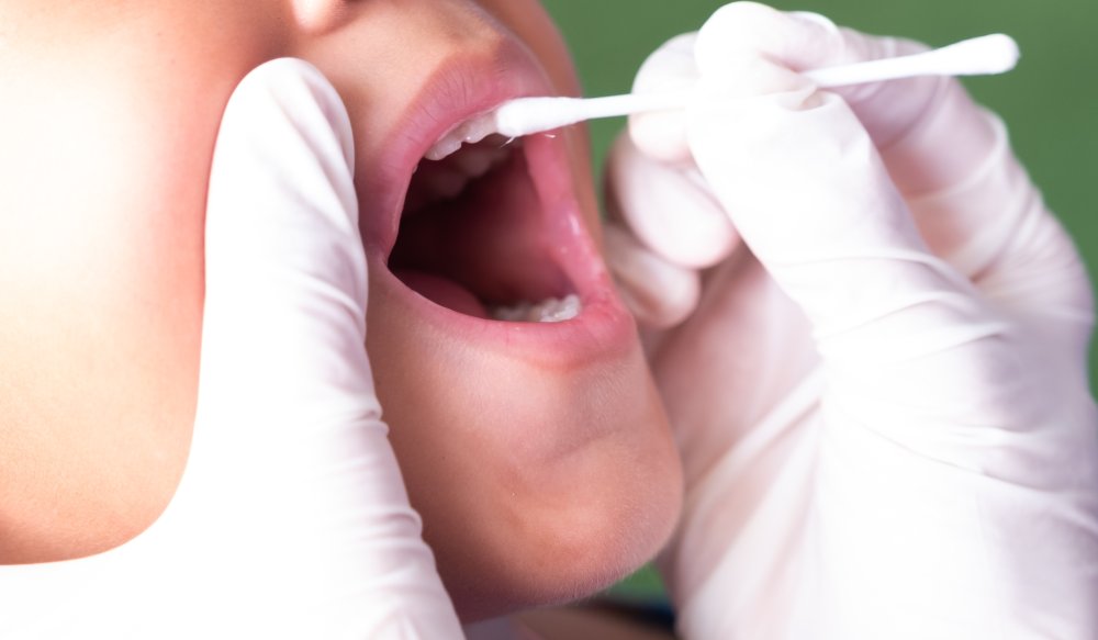 A dentist applies fluoride varnish to children to prevent tooth decay.