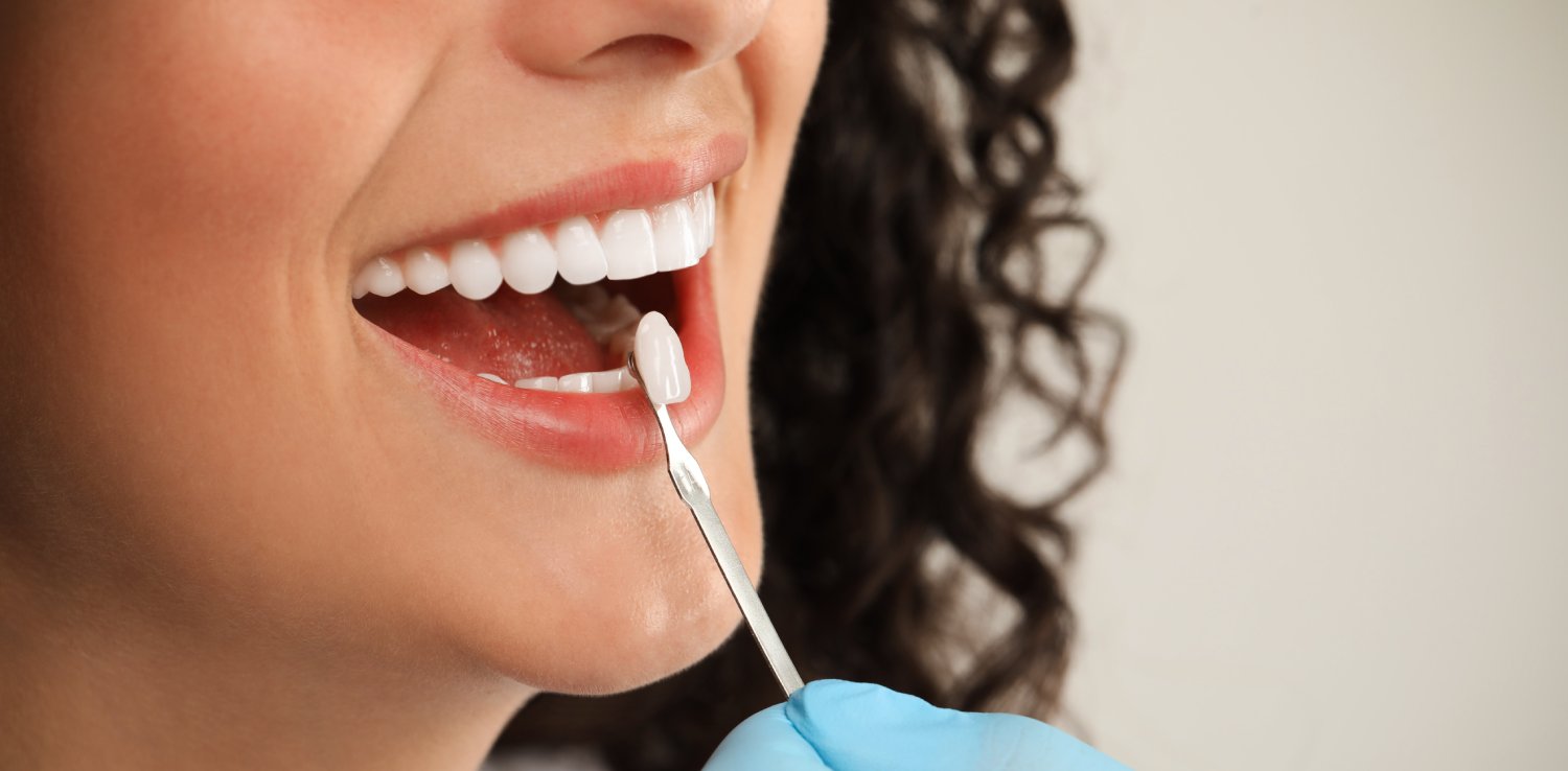Doctor checking young woman's teeth color on light grey background, closeup. Dental veneers
