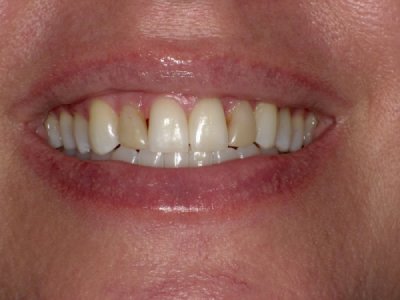 SHOFU DENTAL DIGITAL CAMERA